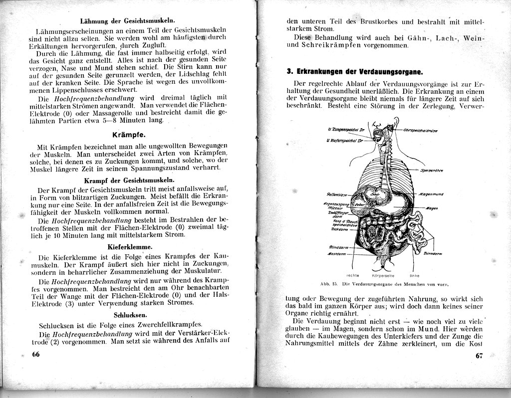 'Hochfrequenz fr Kranke und Gesunde - ein rztl. Ratgeber (1928)'