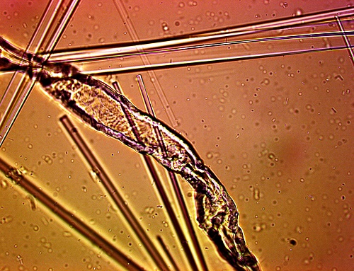 CDB-Biofilament+Proteinkristalle